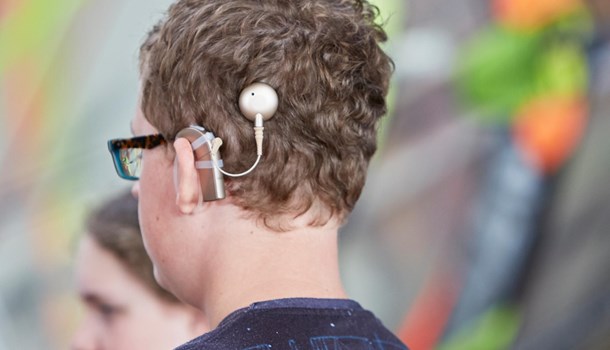 The back of a teenager's head who is wearing a cochlear implant.