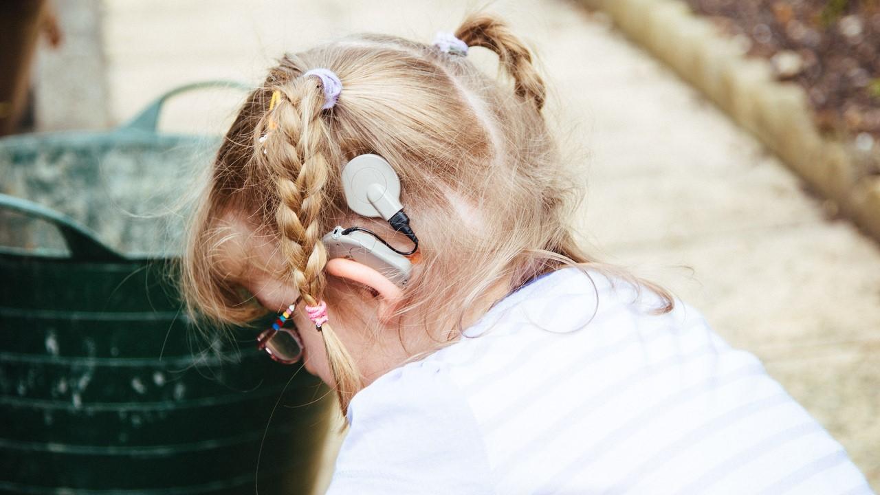 Back of a young girl's head showing her auditory brainstem implant