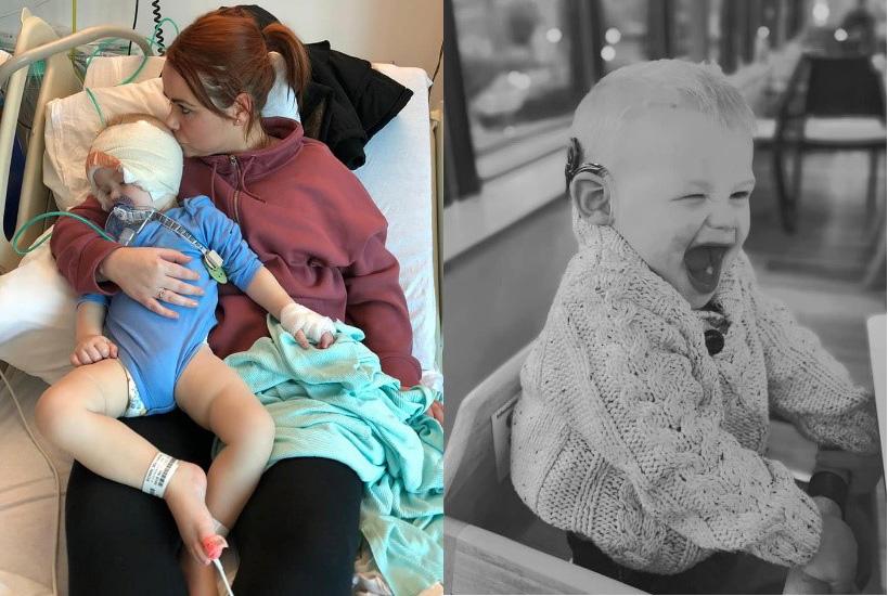 Two images, one of a boy after cochlear implant surgery, the other of the boy wearing his implants and smiling