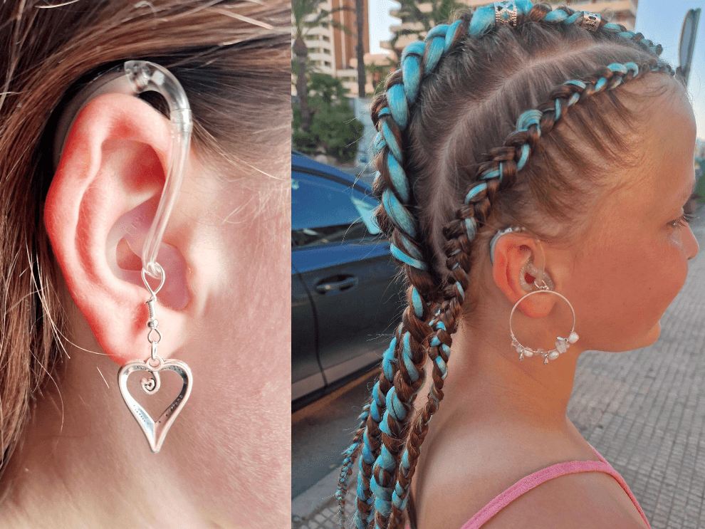 Side view of a girl wearing hearing aids that she has decorated with charms.