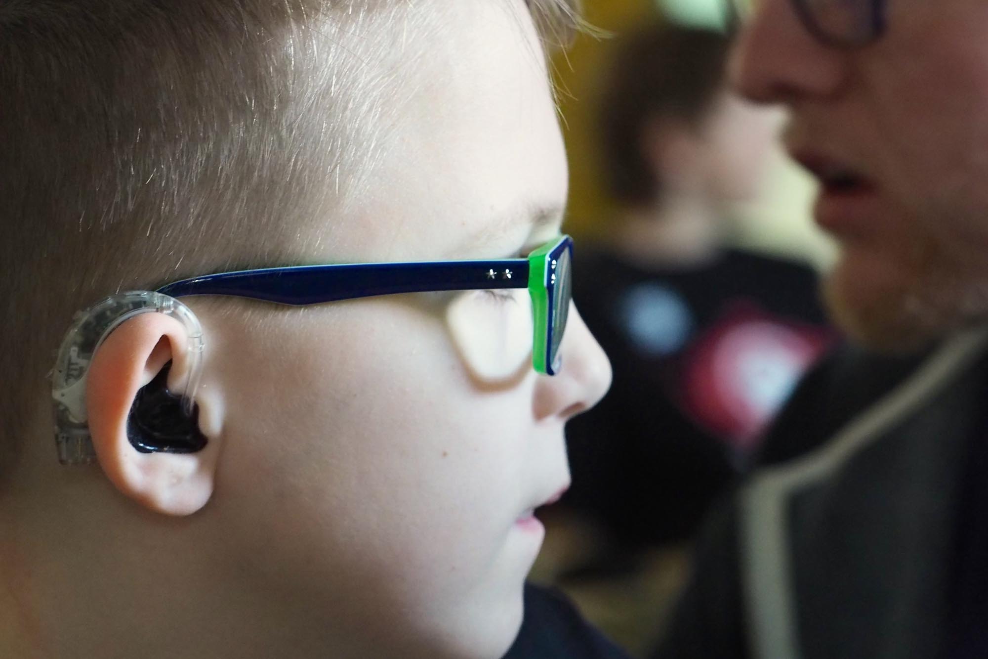 Visual impairment and deaf children Additional needs