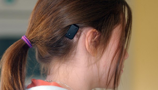 The back of a girl's head who is wearing a bone conduction implant.