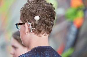 The back of a teenager's head who is wearing a cochlear implant.