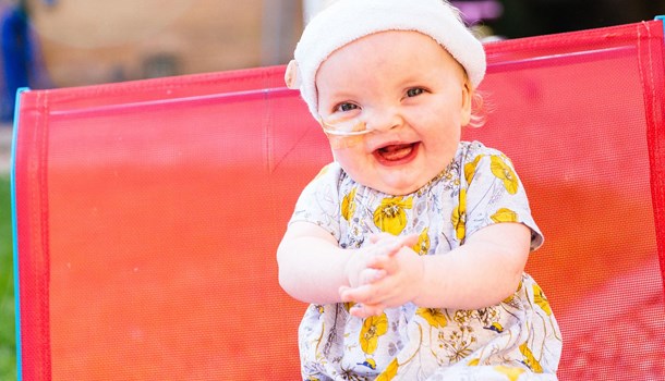One year old Isla laughing with her feeding tube taped to her cheek and a headband on.
