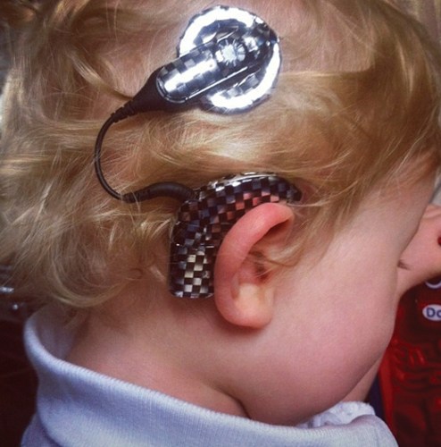 Cochlear implant decorated with race car checks