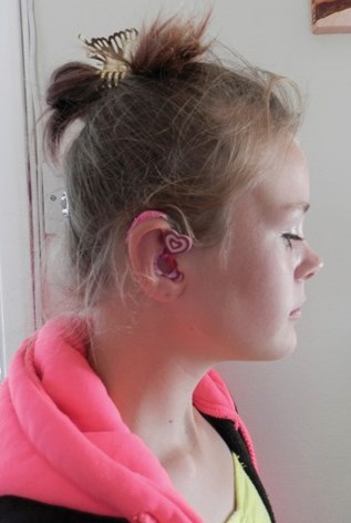 Pink hearing aid decorated with a heart