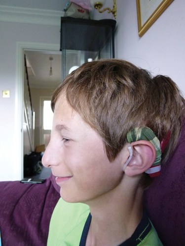 Hearing aids and implants - NHS