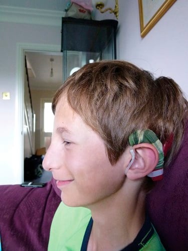 A boy wears cochlear implants that have a green camouflage cover.