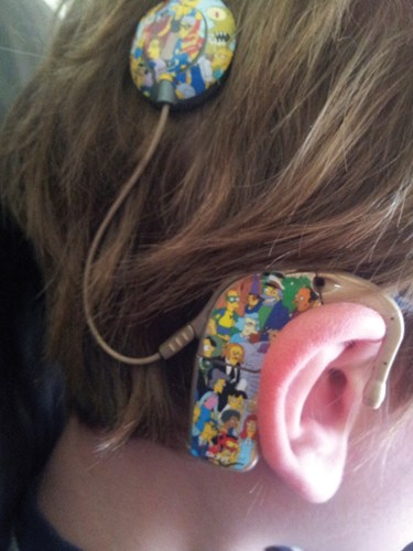 Cochlear implant decorated with Simpsons characters