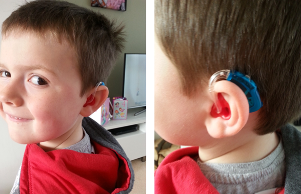 Small boy with hearing aids
