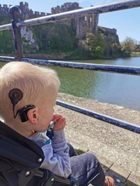 Little boy wearing cochlear implants sitting in a push chair looking at the sea