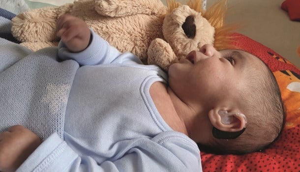 A deaf baby wearing hearing aids laid next to his teddy bear.