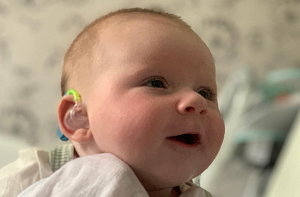 Baby George wearing a blue and green hearing aid