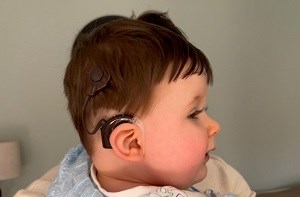 Baby George wearing his new cochlear implant
