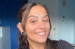 Skye (22) wearing cochlear implants
